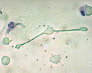Makrophagen